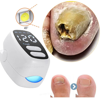 APARELHO LUZ AZUL ANTIFUNGO PARA UNHAS